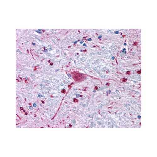 FZD3 / Frizzled 3 (N-Terminus) antibody