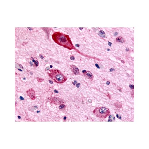 GABBR1 (N-Terminus) antibody