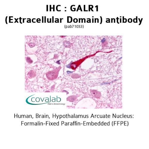 GALR1 (Extracellular Domain) antibody