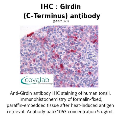 Girdin (C-Terminus) antibody