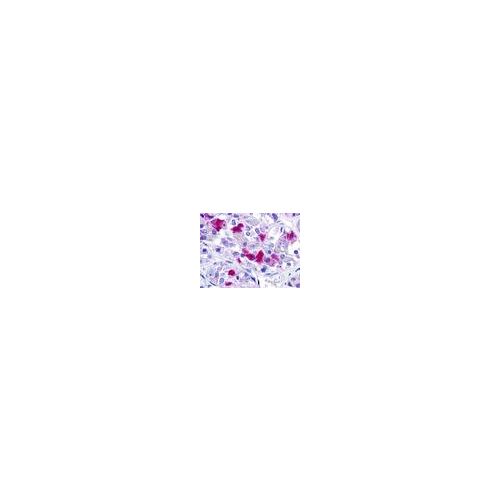 GNRHR (Cytoplasmic Domain) antibody