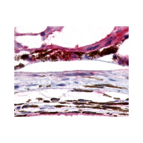 GPR143 (C-Terminus) antibody