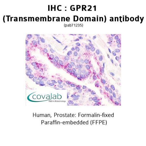 GPR21 (Transmembrane Domain) antibody