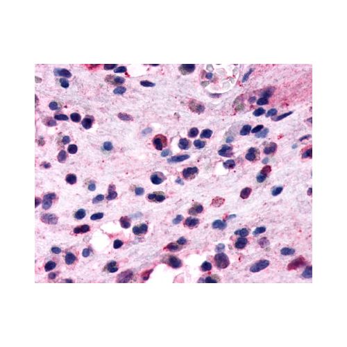 GPR44 / CRTH2 (Extracellular Domain) antibody