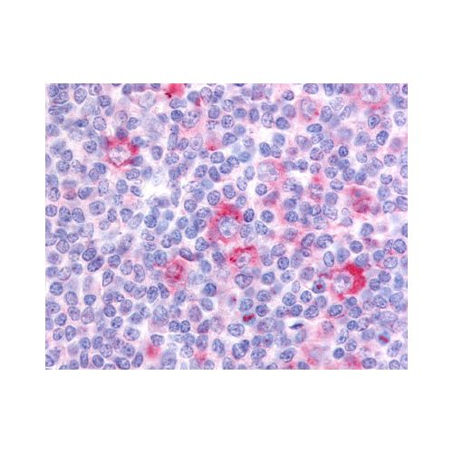 GPR62 (C-Terminus) antibody