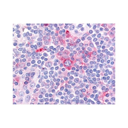 GPR62 (N-Terminus) antibody