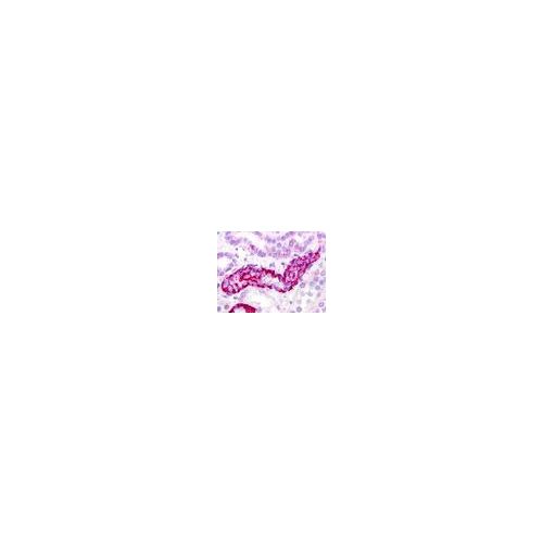 GPRC5D (Extracellular Domain) antibody