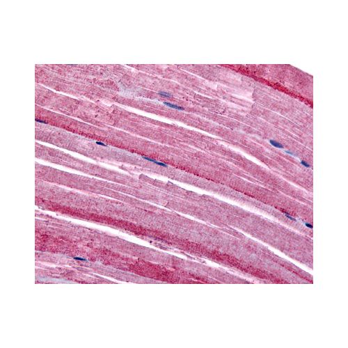 GRK5 (N-Terminus) antibody