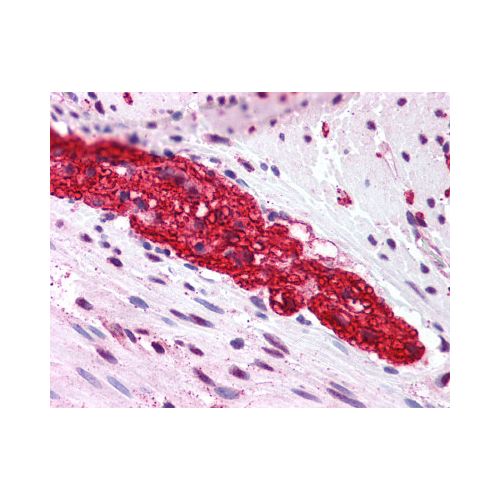 GRM5 / MGLUR5 (N-Terminus) antibody