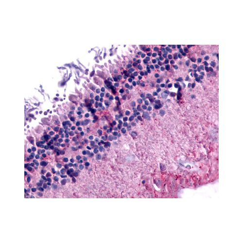 GRM6 / MGLUR6 (N-Terminus) antibody