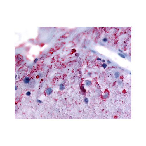 GRM6 / MGLUR6 (N-Terminus) antibody