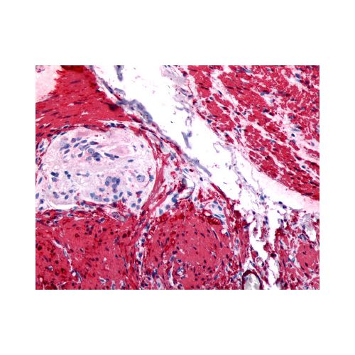 GRPR (Cytoplasmic Domain) antibody