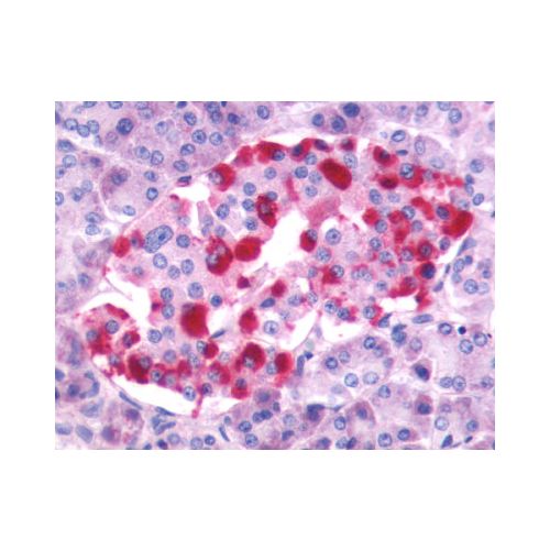 GRPR (Extracellular Domain) antibody