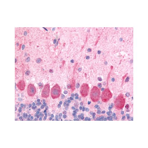 HCRTR1 / Orexin Receptor 1 (Extracellular Domain) antibody