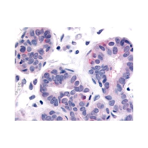 HUNK (Internal) antibody