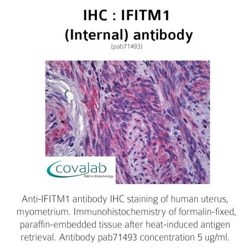 IFITM1 (Internal) antibody