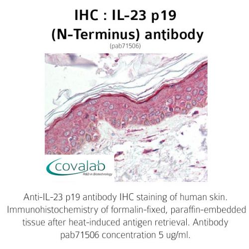 IL-23 p19 (N-Terminus) antibody