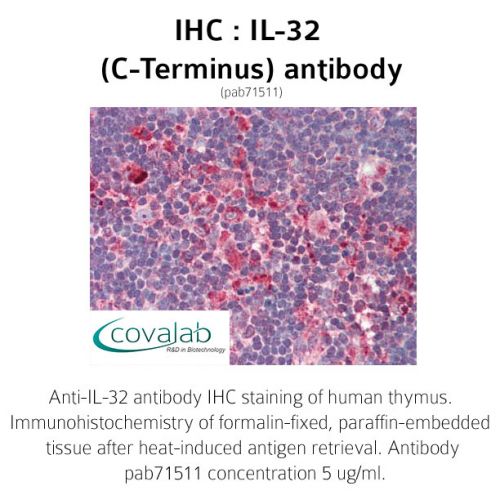 IL-32 (C-Terminus) antibody