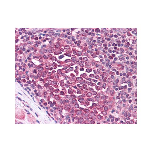 IRAK3 / IRAKM (C-Terminus) antibody