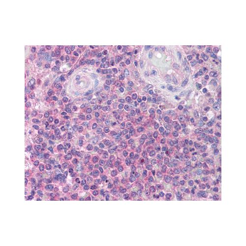 IRAK4 (C-Terminus) antibody