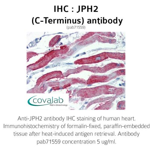 JPH2 (C-Terminus) antibody
