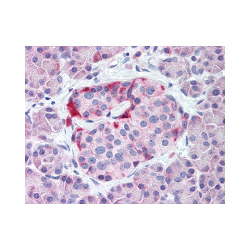 KCNJ6 / GIRK2 (N-Terminus) antibody