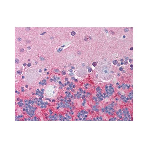 KCNJ6 / GIRK2 (N-Terminus) antibody