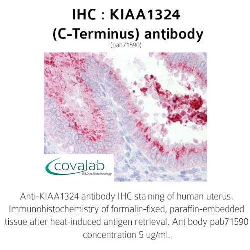 KIAA1324 (C-Terminus) antibody