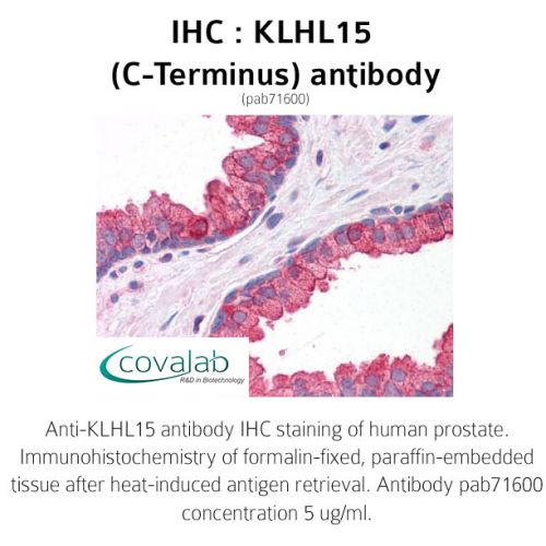 KLHL15 (C-Terminus) antibody