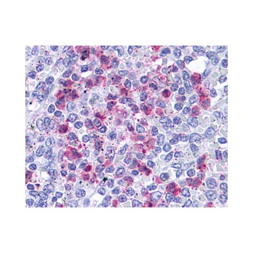 Leukotriene B4 Receptor (C-Terminus) antibody