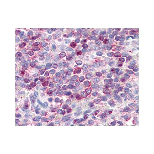 Leukotriene B4 Receptor (Cytoplasmic Domain) antibody