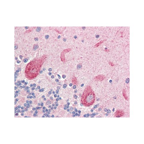 LGI4 (Internal) antibody