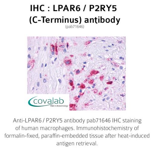 LPAR6 / P2RY5 (C-Terminus) antibody