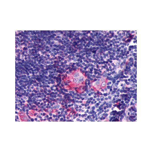 LPAR6 / P2RY5 (Extracellular Domain) antibody