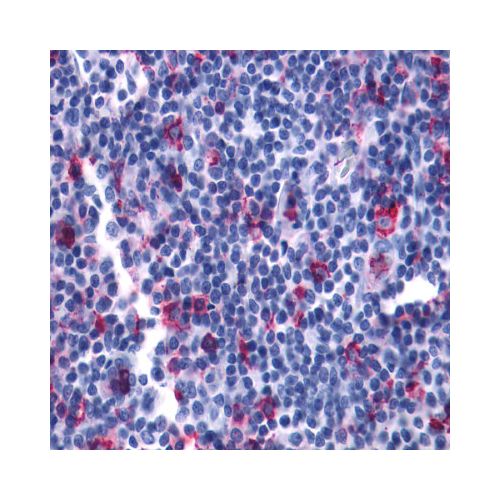 LTB4R2 (C-Terminus) antibody