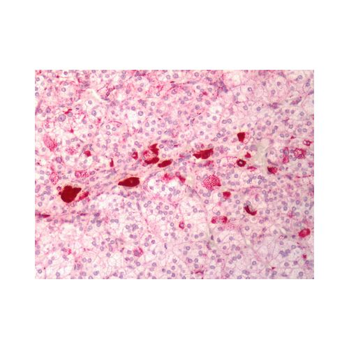 MC1 Receptor (Cytoplasmic Domain) antibody
