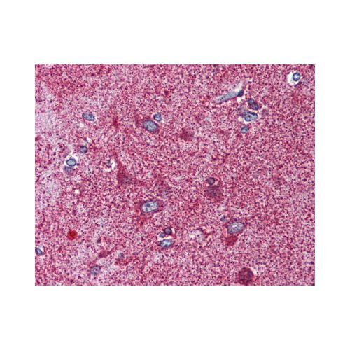 MC3 Receptor (C-Terminus) antibody