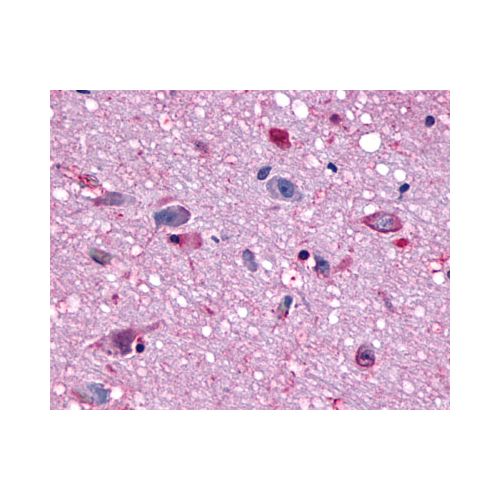 MCHR1 (N-Terminus) antibody