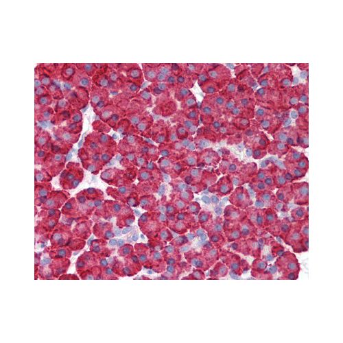 MDA5 (C-Terminus) antibody