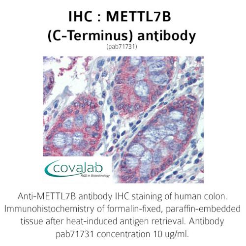 METTL7B (C-Terminus) antibody