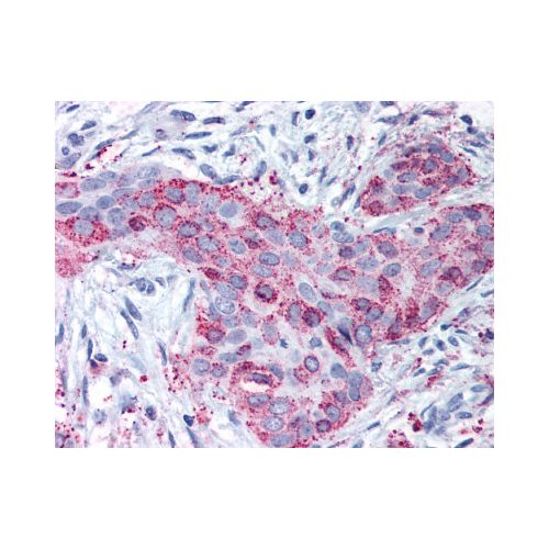 MMP13 (Internal) antibody