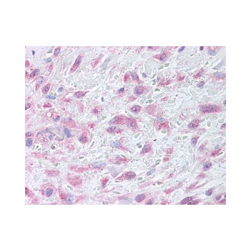 MMP-9 (Internal) antibody