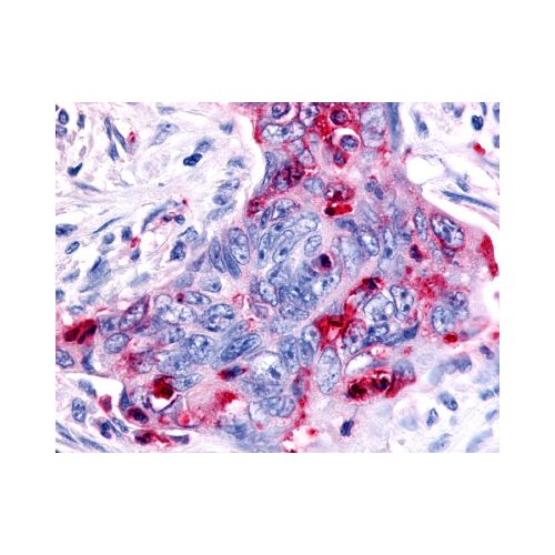 MST1R / RON (C-Terminus) antibody
