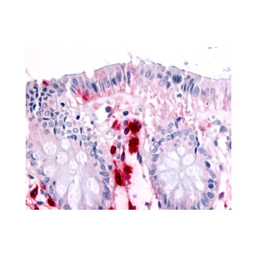 MST1R / RON (Internal) antibody