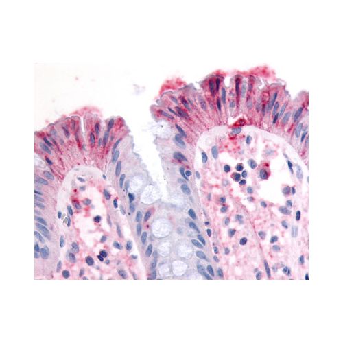 MST1R / RON (N-Terminus) antibody