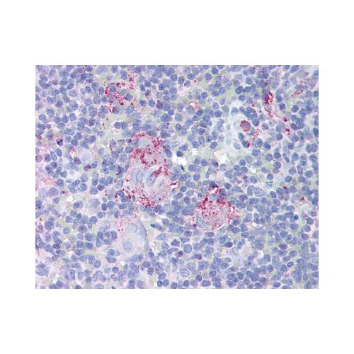 MTBP (aa122-139) antibody