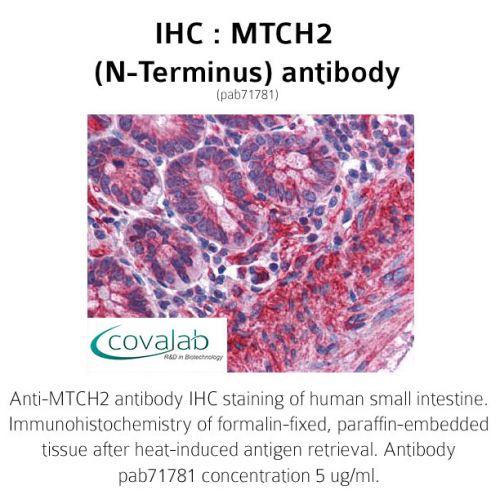 MTCH2 (N-Terminus) antibody