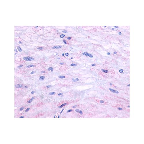 Neurokinin A Receptor (C-Terminus) antibody