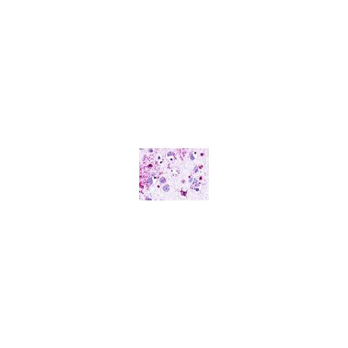NMUR1 (Cytoplasmic Domain) antibody
