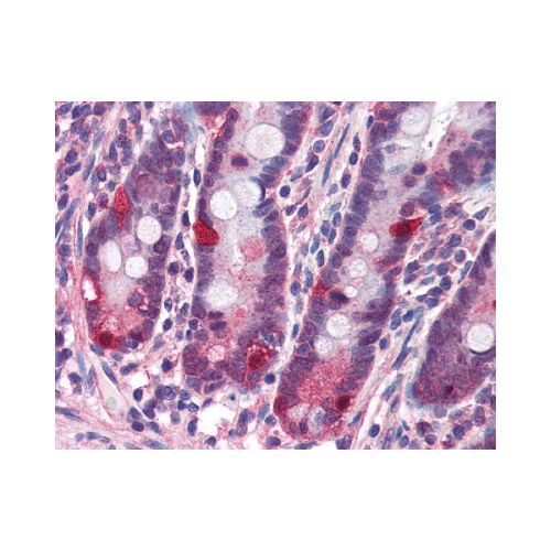 NOD2 (C-Terminus) antibody